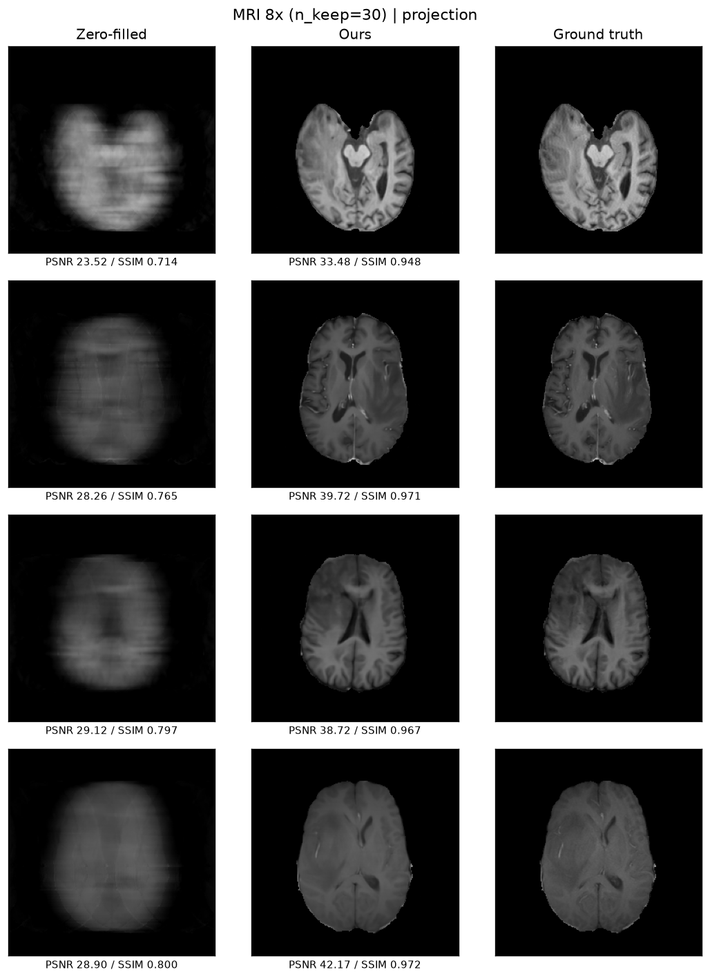 8× accelerated brain-MRI reconstruction, three columns: the blurry zero-filled input on the left, the score-based reconstruction in the middle, and the ground-truth scan on the right, each annotated with its PSNR and SSIM.